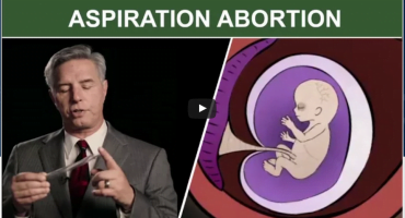 Read more about the article Atsiurbimo abortas pirmajame trimestre (D ir C abortas)