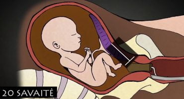 Read more about the article Aborto procedūros ir jo medicininis reikalingumas. Dokumentinis filmas