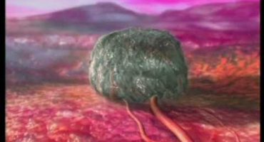 Read more about the article Plaučių vėžys